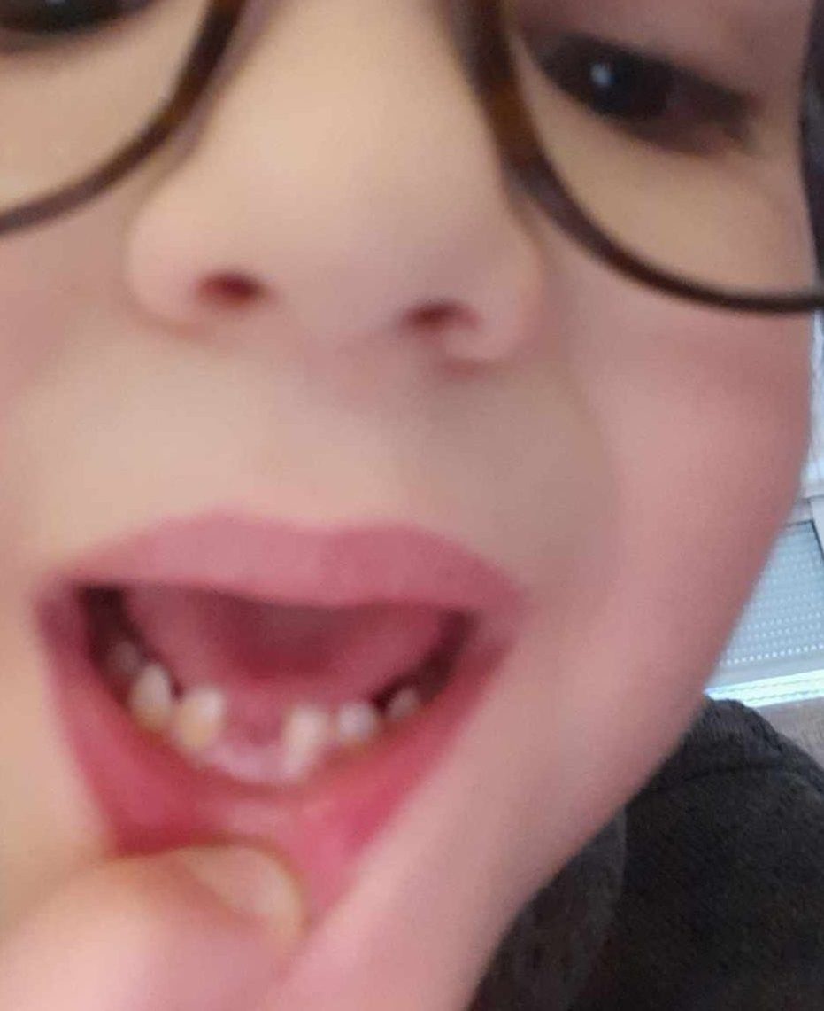 Eliot sa première dent perdue